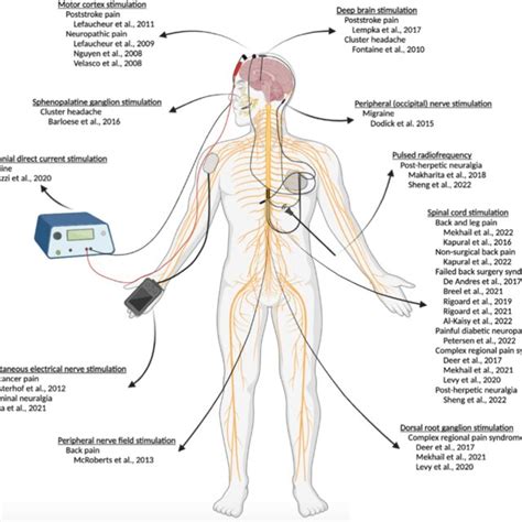 Illustration Of The Neurostimulation Therapies Evaluated In The