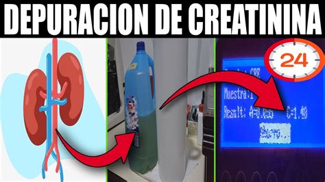 Como Hacer El Examen De DEPURACION DE CREATININA En ORINA De 24 Horas