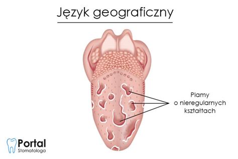 Mięśnie języka Portal Stomatologa