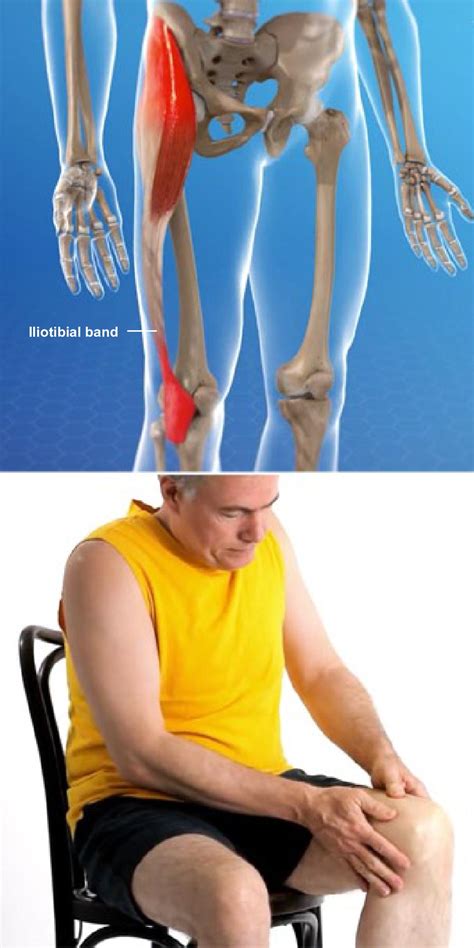 Iliotibial Band Syndrome Treatment