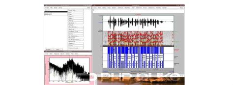 Analysis Of The Speech And Voice Parameters By Using Praat Software In