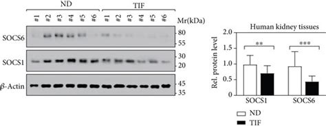 Socs Is The Direct Target Of Mir P A Socs Are Potential