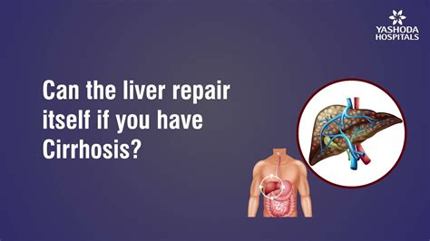 Can The Liver Repair Itself If You Have Cirrhosis Youtube