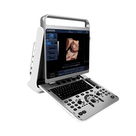 Chison Ebit30 4D 5D Portable Color Doppler Human Ultrasound Gynaecology