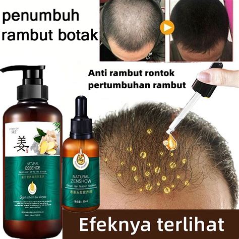 Jual Shampo Herbal Jahe Sampo Penumbuh Rambut Cepat Shampoo Anti