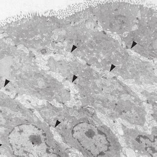 Transmission Electron Photomicrographs Of Mucosal Tissue Of The Right