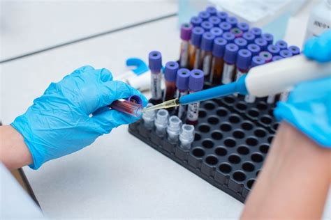 Premium Photo Blood Test In The Laboratory