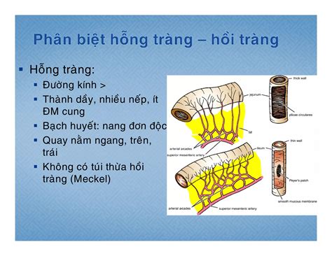 Giải Phẩu Ruột Non Ruột Già Yds Ppt