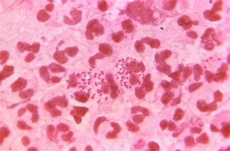 Neisseria Gram Stain