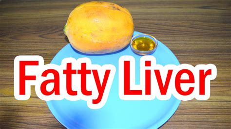 Home Remedy For Fatty Liver Fatty Liver Fatty Liver Remedies Remedies