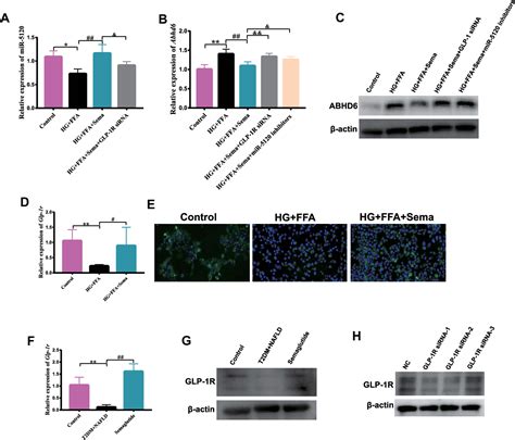 Figure 6 From Semaglutide May Alleviate Hepatic Steatosis In T2DM