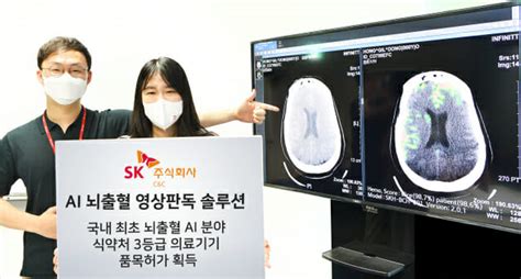 Sk㈜ Candc Ai 뇌출혈 영상판독 솔루션 식약처 3등급 의료기기 품목허가 획득 Zdnet Korea