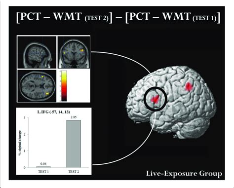 Brain Activation In Mni Space And Roi Analysis For The Left Ifg An