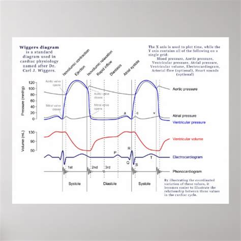 Wiggers Diagram Poster | Zazzle