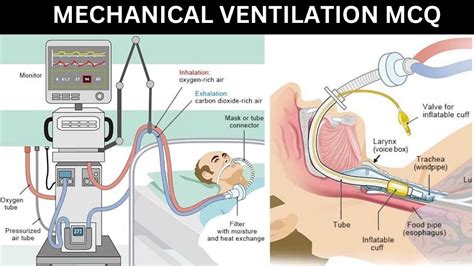 MECHANICAL VENTILATION NURSING MCQ SINGAPORE NURSE EXAM QUESTIONS AND