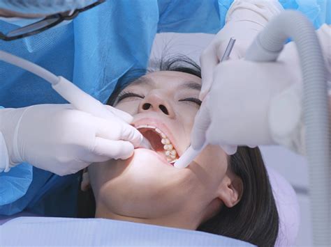 Para qué sirve y qué es el raspado y alisado radicular Dental Clinic