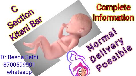 C Section Kitani Bar Possible तय of Normal Delivery after C Section