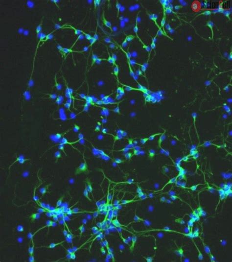 Mouse Neurons Cortical From CD1