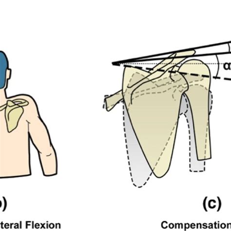 Calibration Model Of The Compensatory Movement From Shoulder Girdle Download Scientific Diagram