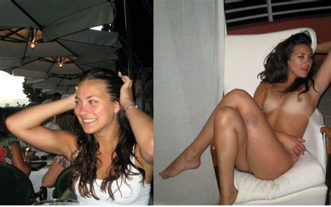 That S A Bruise Porn Pic