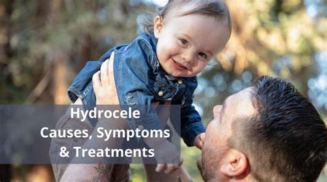 Hydrocele – Causes, Symptoms & Treatment – National Testicular Cancer Society