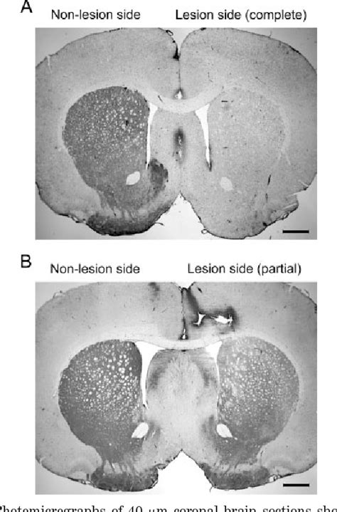 Figure 1 From Evaluation Of Levodopa Dose And Magnitude Of Dopamine