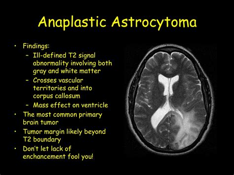 Ppt Anoxic Brain Injury Powerpoint Presentation Free Download Id 9709070