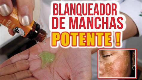 El M S Potente Aclarador Para Acabar Con Manchas En La Piel Youtube