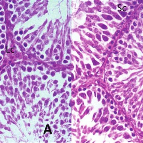 Photomicrographs Of Histological Sections Of The Testis From The Adult