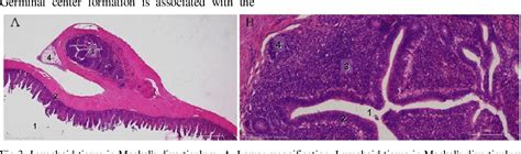 Figure 1 from Meckel's diverticulum in animals and birds: An immuno ...