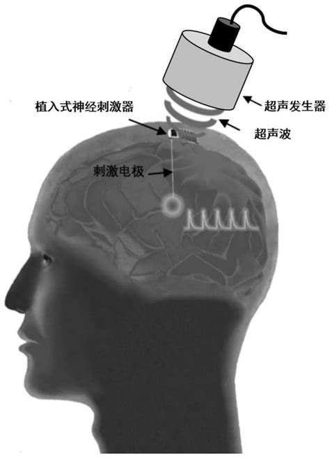 Battery Free Flexible Implantable Deep Brain Stimulator Battery Free Flexible Implantable Deep