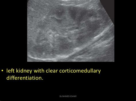 10 Fetal Urinary Tract Dr Ahmed Esawy