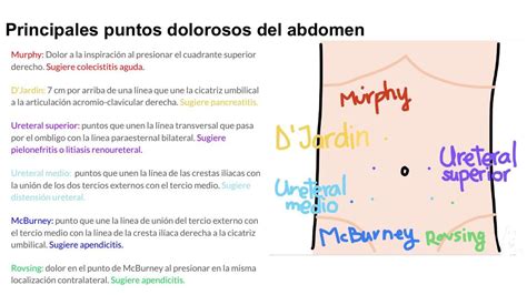 Puntos Dolorosos Del Abdomen Doctora Any Udocz