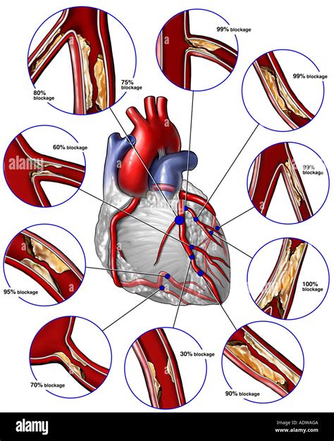 Arteria coronaria circunfleja fotografías e imágenes de alta resolución