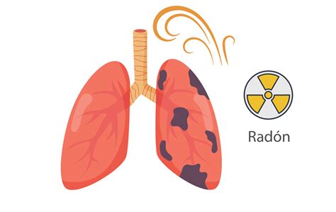 El Radón En México Un Riesgo Radiactivo De La Naturaleza Grupo