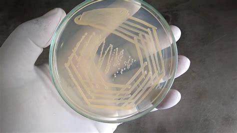 Staphylococcus Aureus Colony Morphology