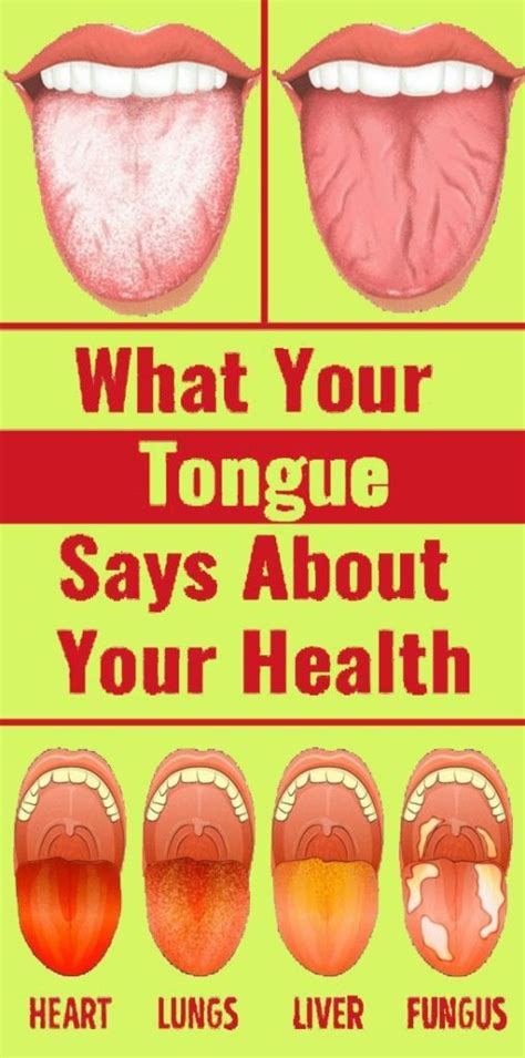 Health Infographic What Your Tongue Can Tell You About Your Health