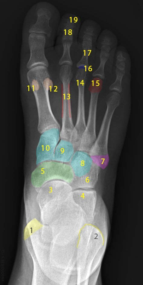 Normal radiographic anatomy of the foot | Radiology Case | Radiopaedia ...