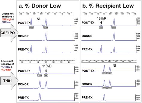 Chimerism Testing in Allogeneic Hematopoietic Stem Cell Transplantation ...