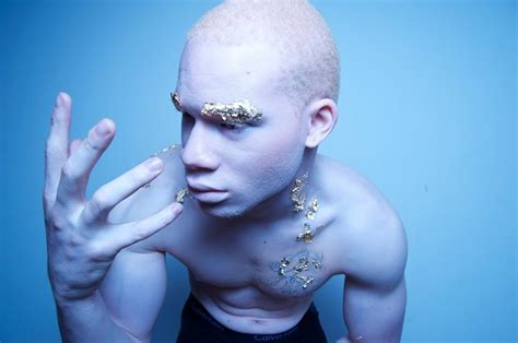 albino models, albino actors, sir maejor, shuan ross, | Flickr