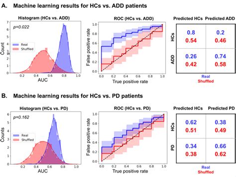 Automated text-level semantic markers of Alzheimer’s disease | Alzheimer's & Dementia: Diagnosis ...