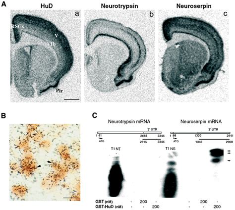 HuD Co Localizes With Neuroserpin MRNA In The Rat Brain And Binds To