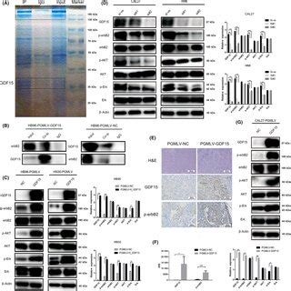 Growth Differentiation Factor Gdf Intervention On The