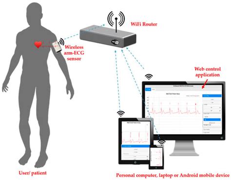 Electronics Free Full Text Arm Ecg Wireless Sensor System For