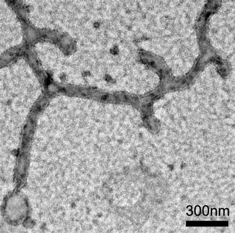 Electron Micrograph Of A Test [image] Eurekalert Science News Releases