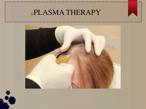 Hair Transplant Ppt