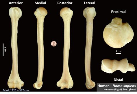 Human Humerus Osteoid Bone Identification