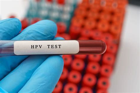 آزمایش hpv اچ پی وی چیست آزمایشگاه تخصصی کوثر مشهد