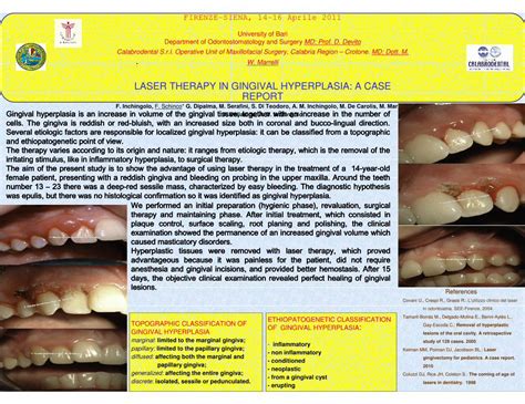 Pdf Laser Therapy In Gingival Hyperplasia A Case Report From A