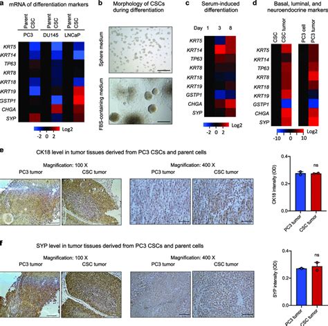 Differentiation Potential Of Prostate CSCs A Expression Levels Of